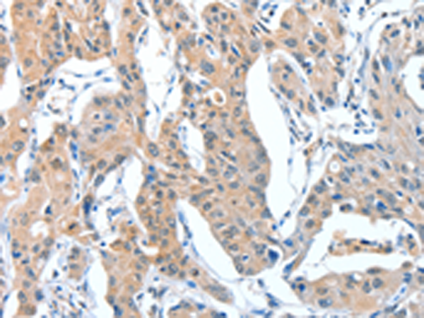 Anti-ADAM7 Rabbit Polyclonal Antibody