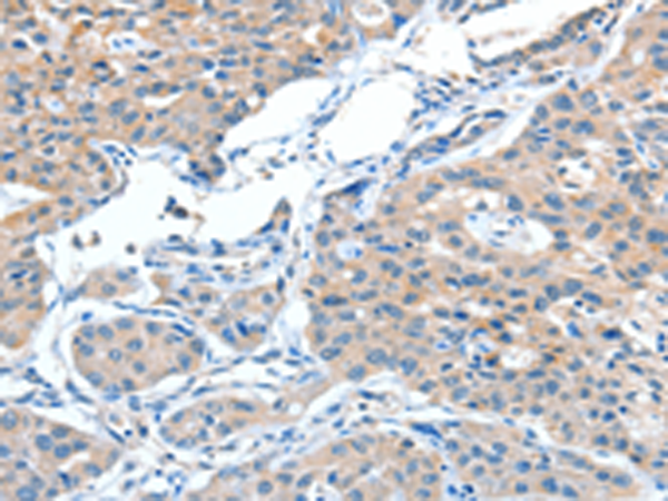 Anti-ADAMTSL1 Rabbit Polyclonal Antibody