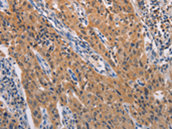 Anti-ADAMDEC1 Rabbit Polyclonal Antibody