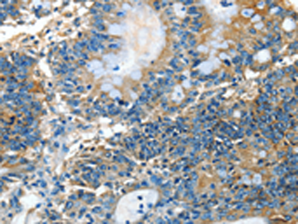 Anti-ADCK4 Rabbit Polyclonal Antibody