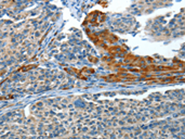 Anti-ADCY4 Rabbit Polyclonal Antibody