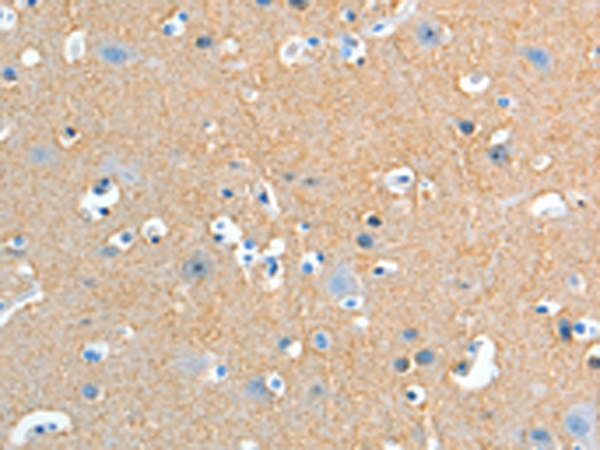 Anti-ADD2 Rabbit Polyclonal Antibody