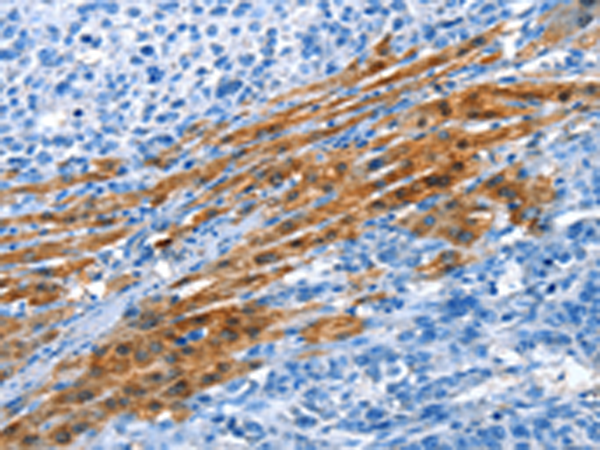 Anti-ADH4 Rabbit Polyclonal Antibody