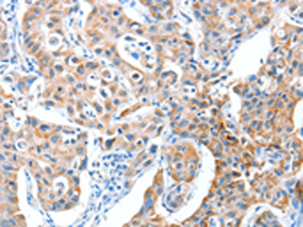 Anti-AEBP2 Rabbit Polyclonal Antibody