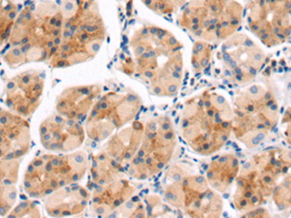 Anti-AFAP1 Rabbit Polyclonal Antibody