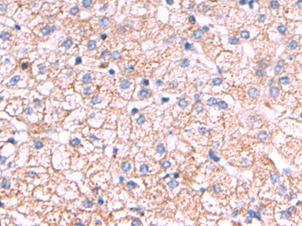 Anti-AGA Rabbit Polyclonal Antibody