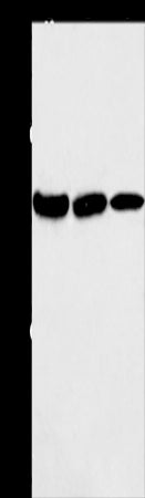 Anti-AGA Rabbit Polyclonal Antibody