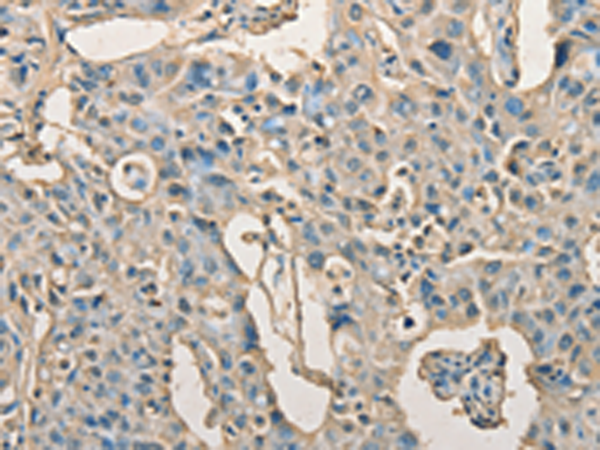 Anti-AGBL2 Rabbit Polyclonal Antibody