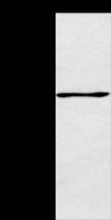 Anti-AGBL2 Rabbit Polyclonal Antibody