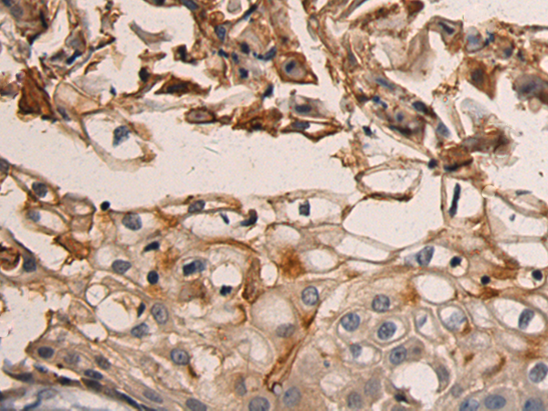 Anti-AGBL3 Rabbit Polyclonal Antibody