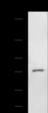 Anti-AGBL3 Rabbit Polyclonal Antibody