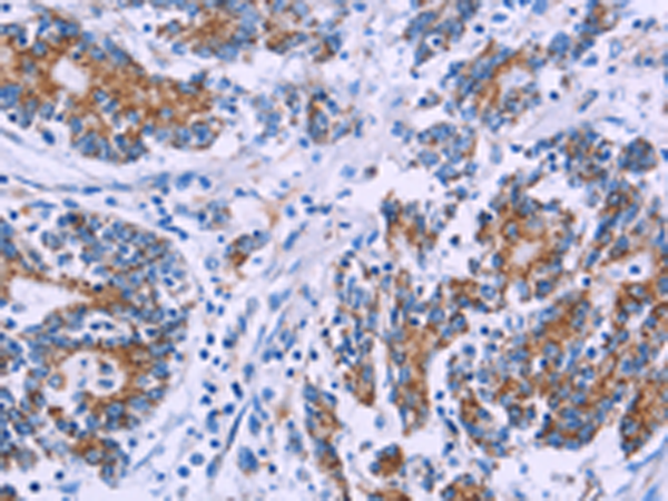 Anti-AGFG1 Rabbit Polyclonal Antibody