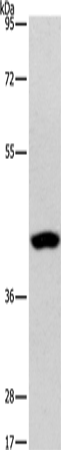 Anti-AGXT2L2 Rabbit Polyclonal Antibody