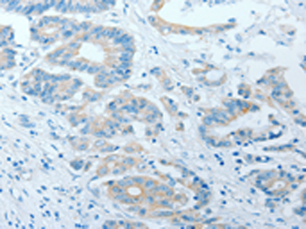 Anti-AKAP7 Rabbit Polyclonal Antibody