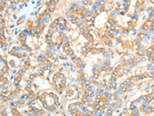 Anti-AKAP4 Rabbit Polyclonal Antibody