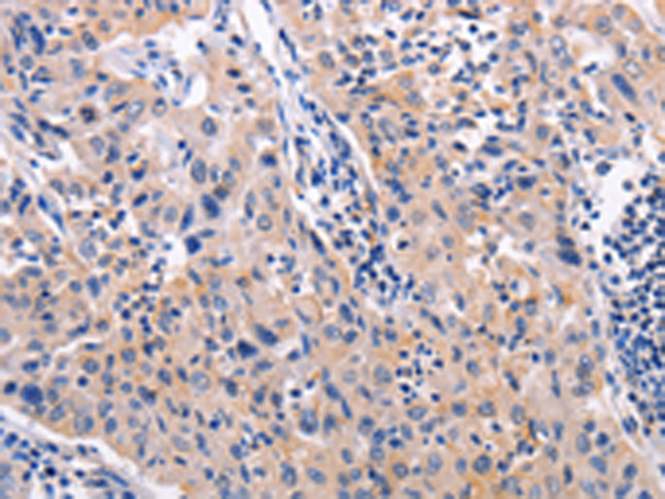 Anti-AKR1B10 Rabbit Polyclonal Antibody