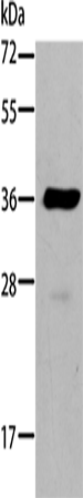 Anti-AKR1B10 Rabbit Polyclonal Antibody