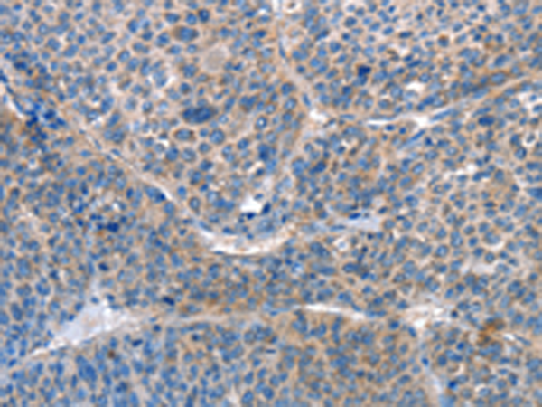 Anti-AKR1D1 Rabbit Polyclonal Antibody