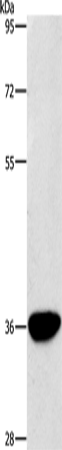 Anti-AKR1D1 Rabbit Polyclonal Antibody