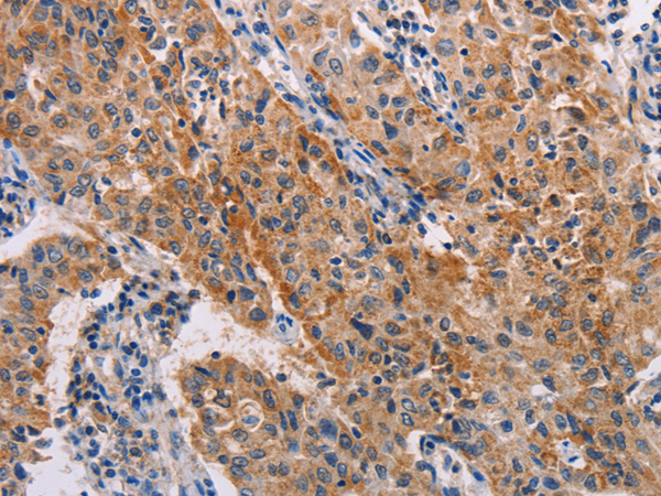 Anti-Alcohol Dehydrogenase Rabbit Polyclonal Antibody