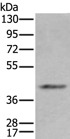 Anti-Alcohol Dehydrogenase Rabbit Polyclonal Antibody