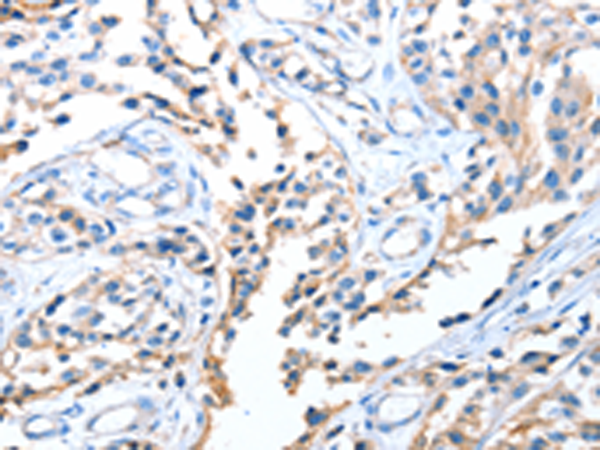Anti-Aldehyde Oxidase Rabbit Polyclonal Antibody