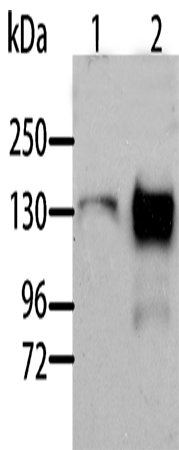 Anti-Aldehyde Oxidase Rabbit Polyclonal Antibody