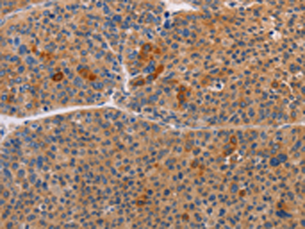 Anti-ALDH3A1 Rabbit Polyclonal Antibody