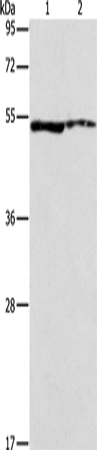 Anti-ALDH3A1 Rabbit Polyclonal Antibody