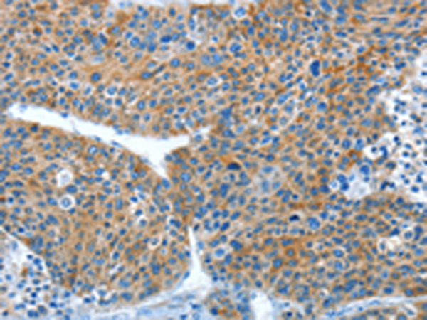 Anti-ALDH3B1 Rabbit Polyclonal Antibody