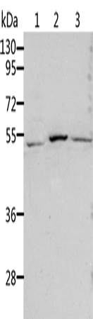 Anti-ALDH3B1 Rabbit Polyclonal Antibody