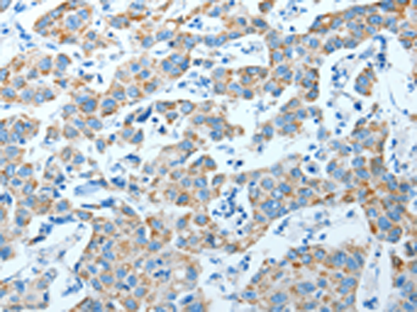 Anti-ALDH4A1 Rabbit Polyclonal Antibody