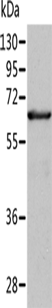 Anti-ALDH4A1 Rabbit Polyclonal Antibody