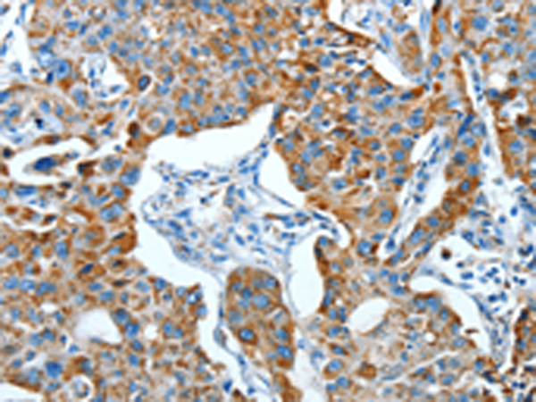 Anti-ALDH6A1 Rabbit Polyclonal Antibody
