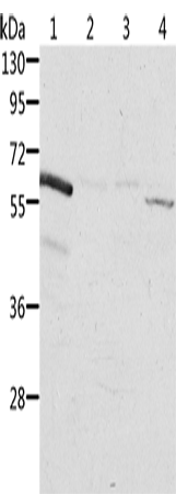 Anti-ALDH6A1 Rabbit Polyclonal Antibody