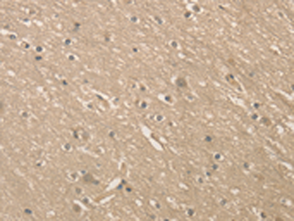 Anti-ALDH8A1 Rabbit Polyclonal Antibody