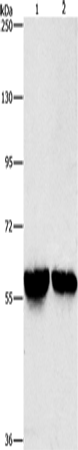 Anti-ALDH8A1 Rabbit Polyclonal Antibody