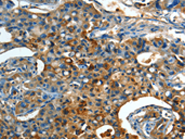 Anti-ORM1 Rabbit Polyclonal Antibody