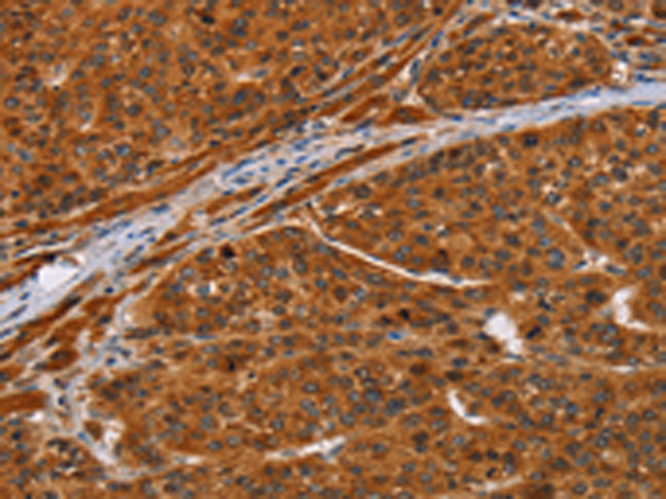 Anti-NIF3L1 Rabbit Polyclonal Antibody