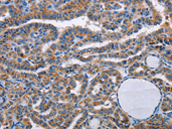 Anti-STRADB Rabbit Polyclonal Antibody