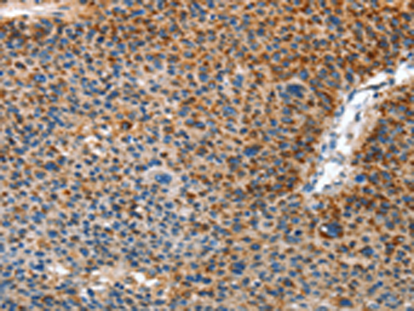 Anti-AMDHD2 Rabbit Polyclonal Antibody