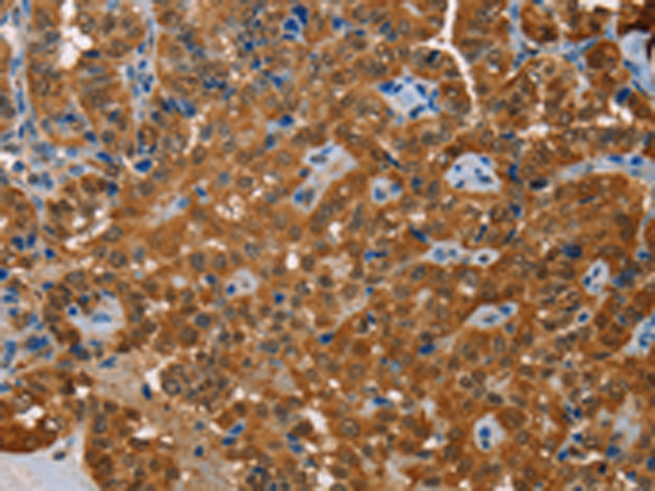 Anti-ACY1 Rabbit Polyclonal Antibody