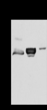 Anti-ACY1 Rabbit Polyclonal Antibody