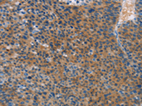 Anti-STAMBP Rabbit Polyclonal Antibody