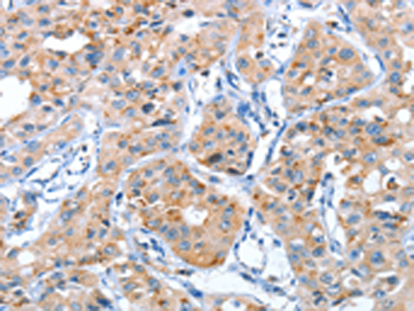 Anti-AUP1 Rabbit Polyclonal Antibody