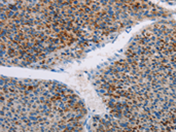 Anti-AMOTL2 Rabbit Polyclonal Antibody