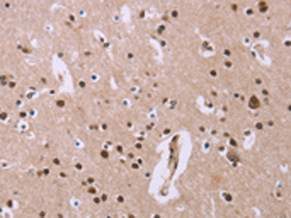 Anti-Anillin Rabbit Polyclonal Antibody