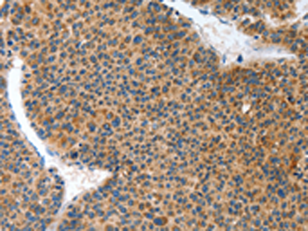 Anti-ANKRD54 Rabbit Polyclonal Antibody