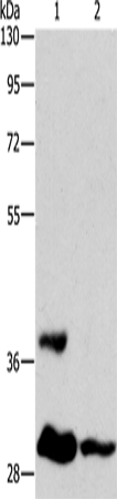 Anti-ANKRD54 Rabbit Polyclonal Antibody