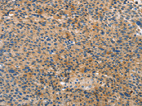 Anti-Annexin A10 Rabbit Polyclonal Antibody